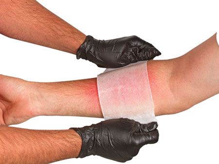 NAR - BurnTec Burn Dressing