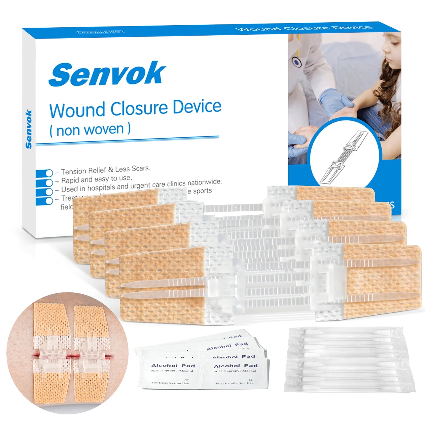 SENVOK - Advanced Wound Closure with Interlaced Locking Technology