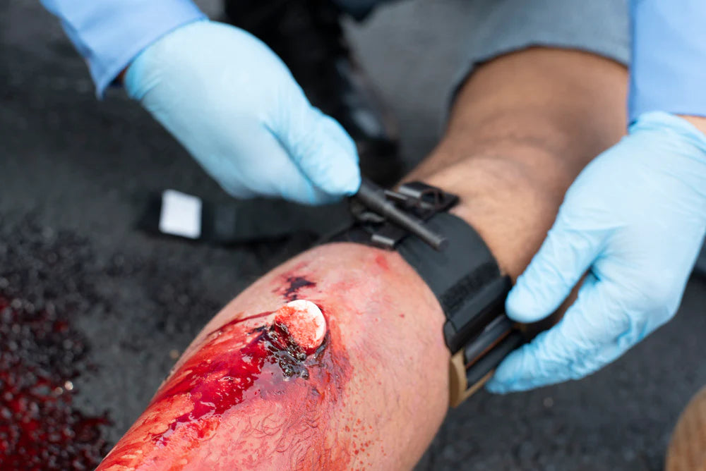 SafeGuard Medical - TMT™ Tourniquet